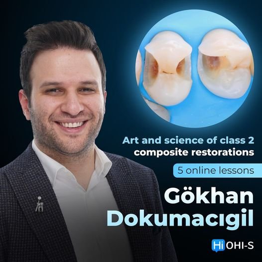 Art and science of class 2 composite restorations 1.jpg