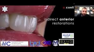 Ceramic and Composite Veneers All Techniques.jpeg