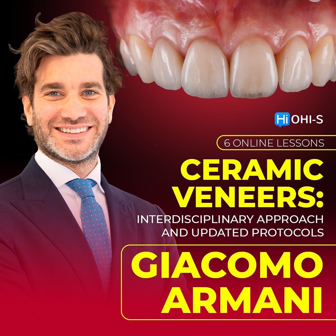 Ceramic Veneers Interdisciplinary Approach and Updated Protocols 6.jpg