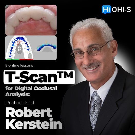 T-Scan™ for Digital Occlusal Analysis Protocols of Robert Kerstein.jpg