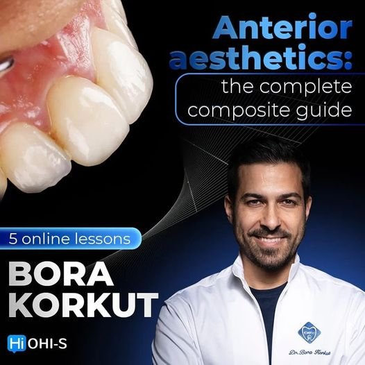 Anterior aesthetics the complete composite guide.jpg