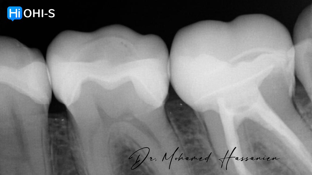 Complete Prosthetic Protocols CAD CAM CEREC 3.jpg