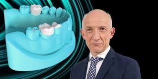 Bonding of Aesthetic Restorations Detailed Protocols and Video Guides.jpeg