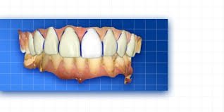 Complete Prosthetic Protocols CAD CAM CEREC.jpeg