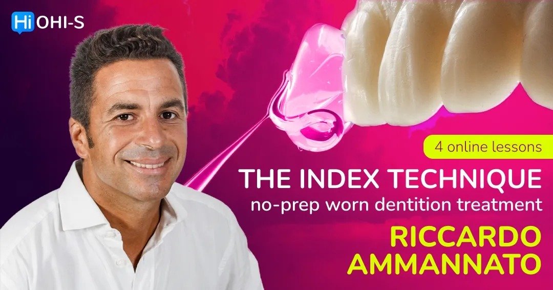 The Index Technique. No-prep worn dentition treatment 4.jpg