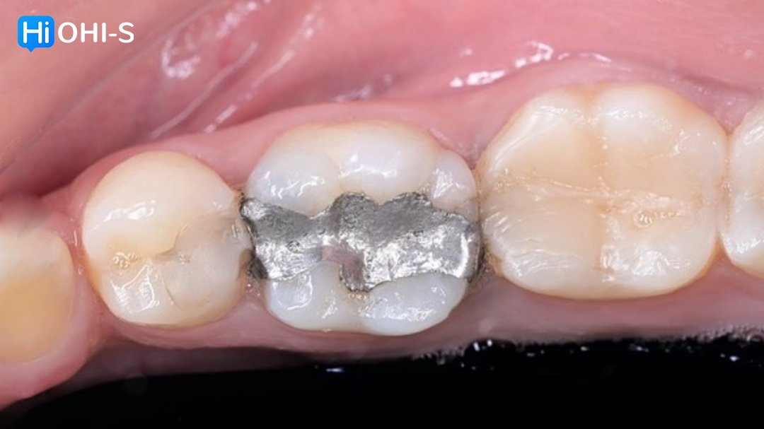 Complete Prosthetic Protocols CAD CAM CEREC 6.jpg