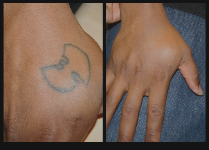 Tattoo Covering For Business Meeting