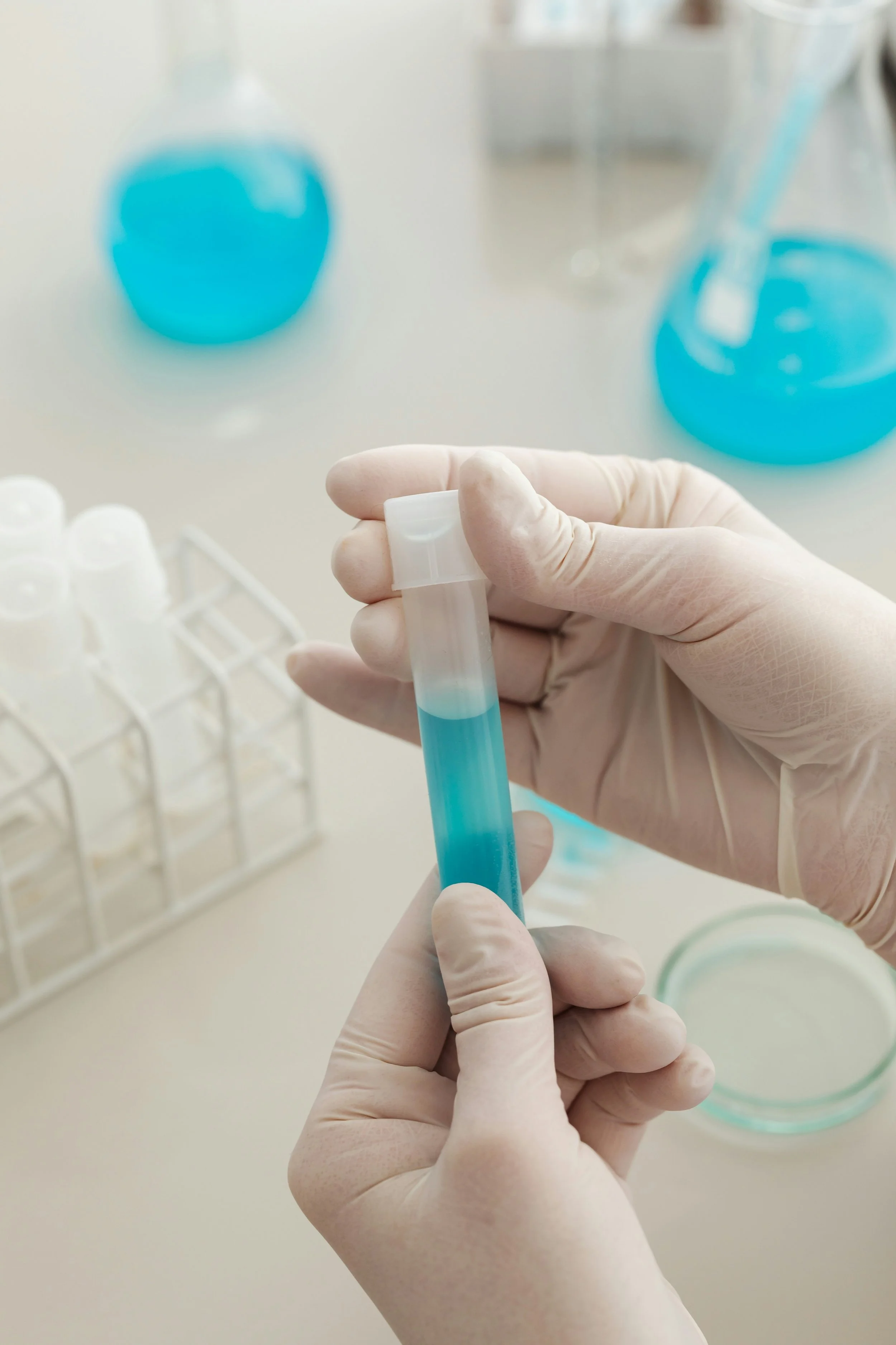 Five Panel Urine Test