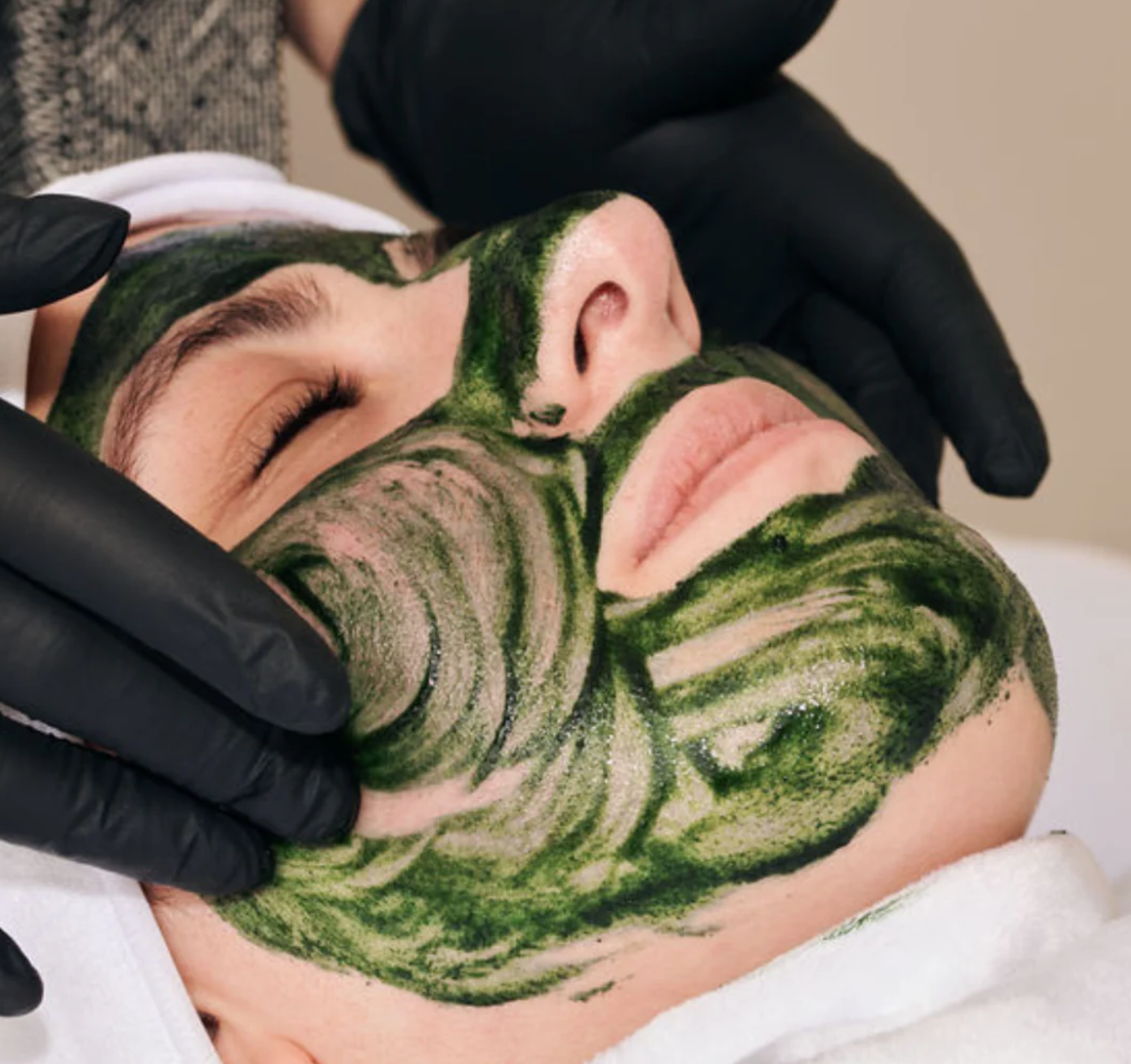 Person receiving a resurfacing peel by an esthetician
