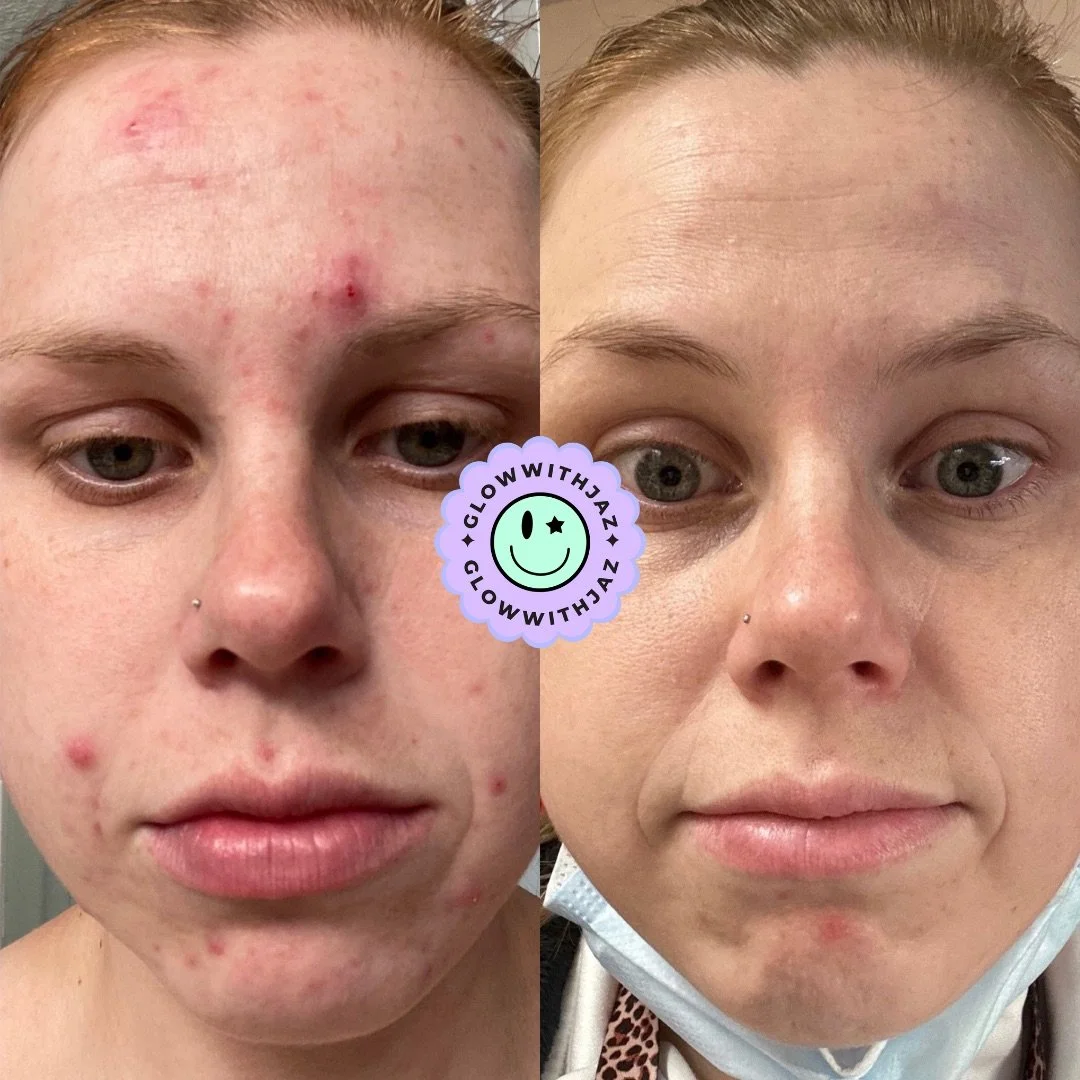 Untitled design - 10.JPG