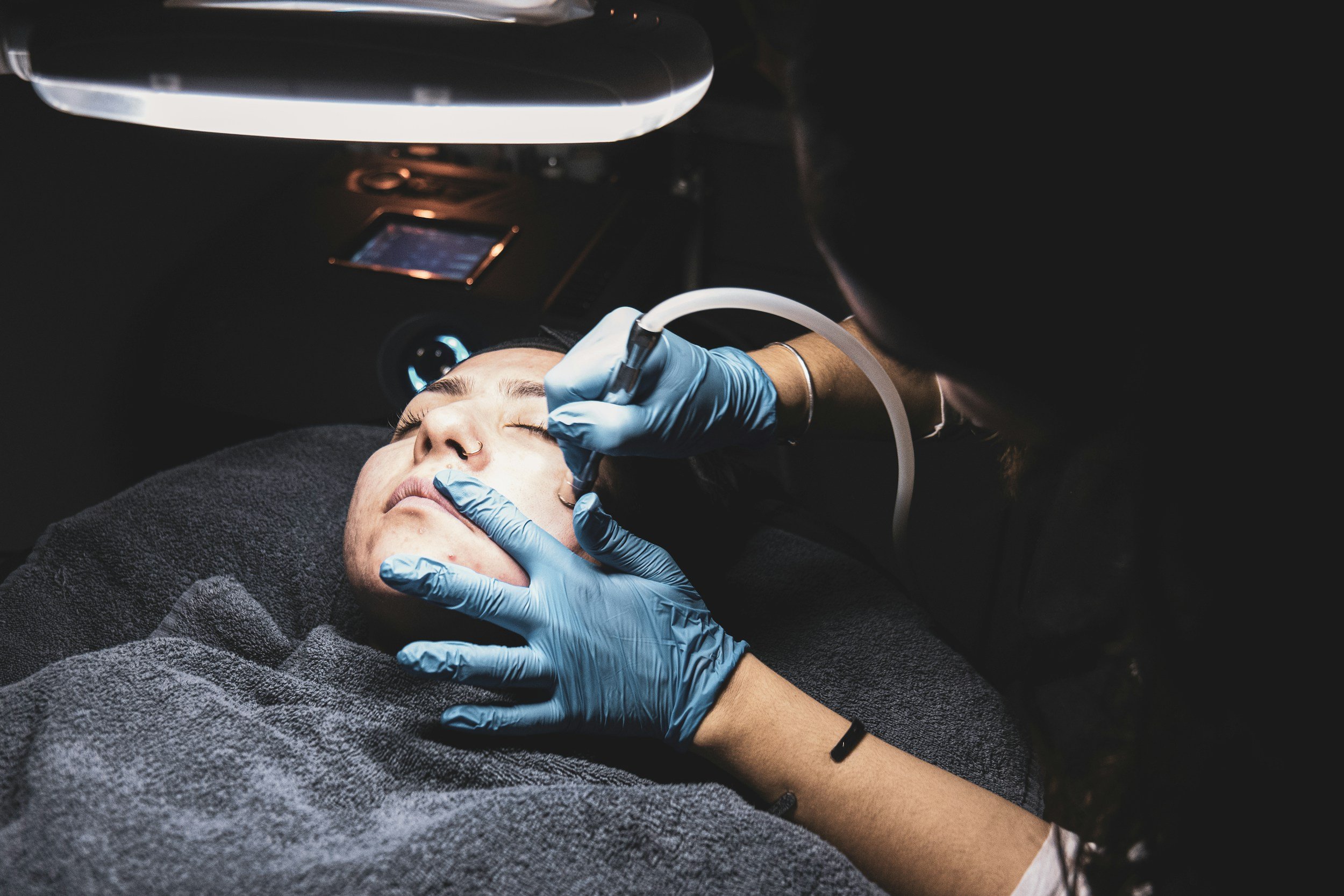 EXION vs Morpheus8 RF Microneedling: Which Is Better?