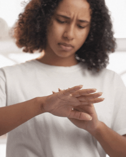 Woman looking down at her dry hands, illustrating common winter skin dryness and discomfort.