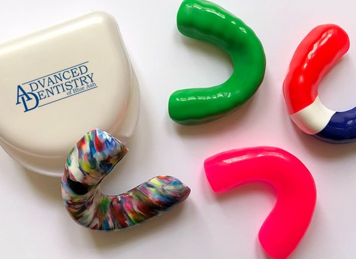 Why a Dentist-Made Mouthguard Is Worth It for Athletes