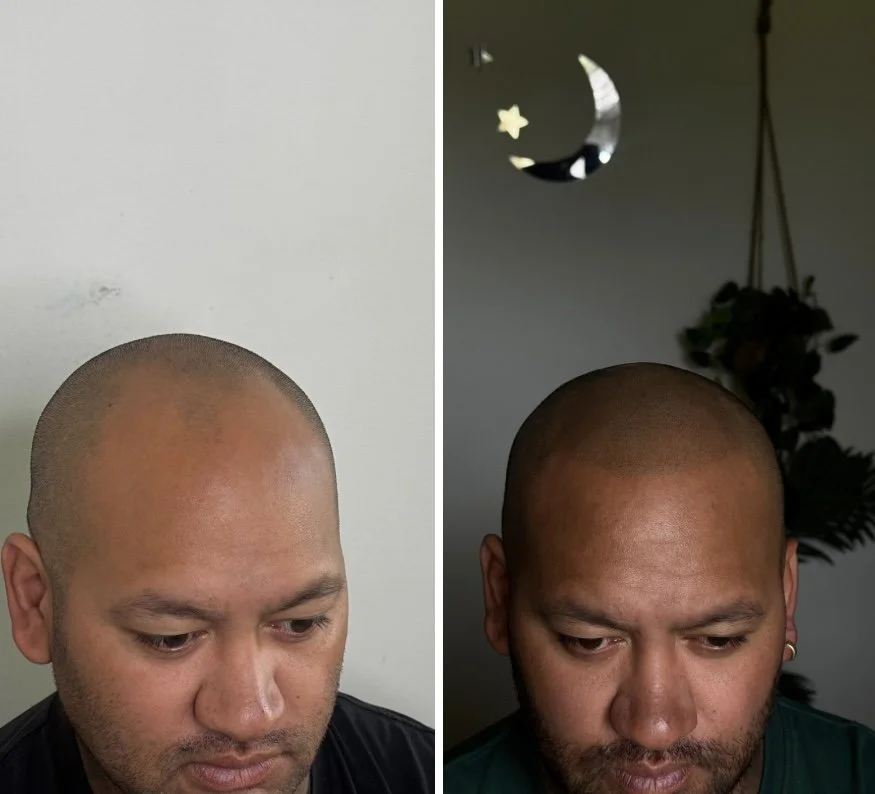 Before after minimal skincare Instagram post.jpg