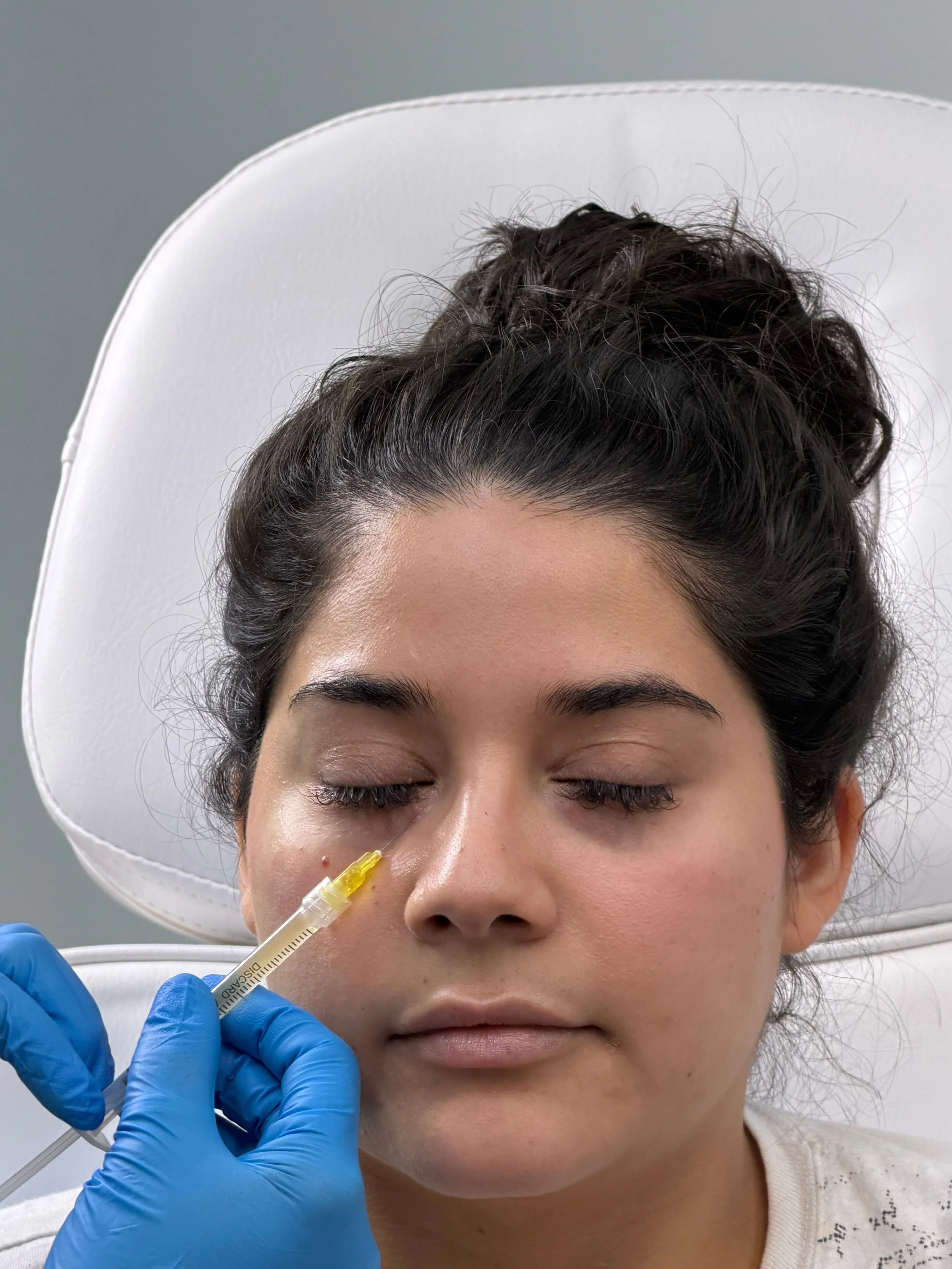 PRP, PRF, and PRP Microneedling: What They Are, How They Work, and Which Is Right for You