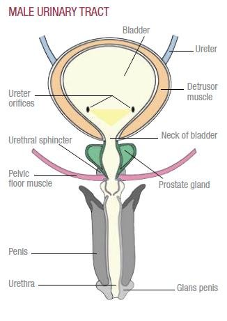 Urinary Incontinence Drawing Urinary Incontinence | Canadian Continence Foundation — Canadian ...