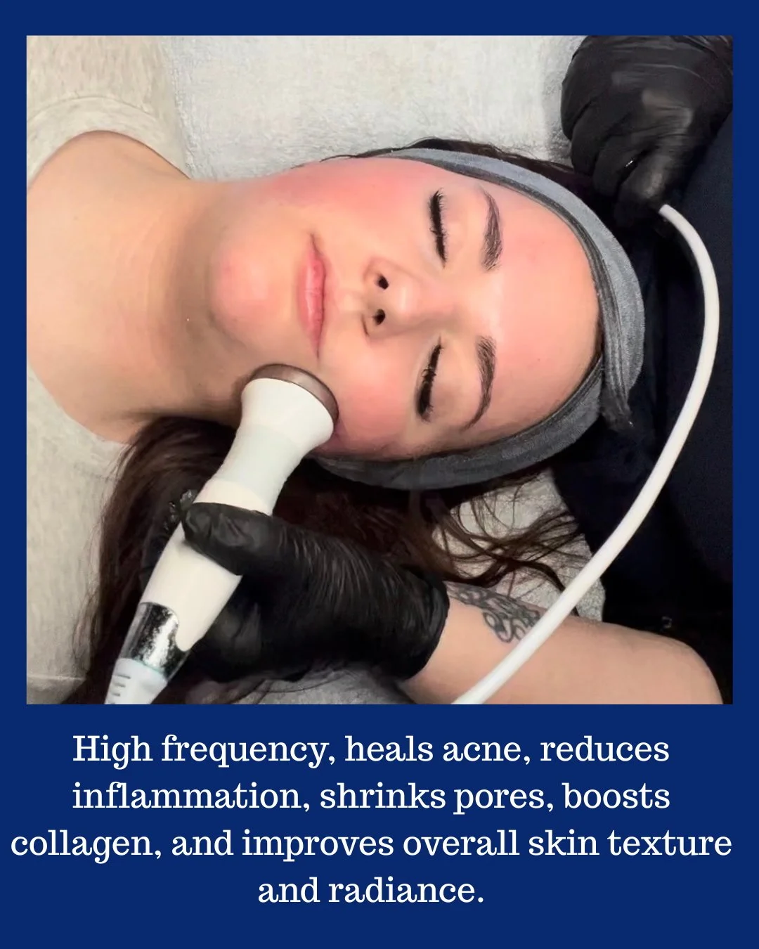 Deep exfoliation and skin resurfacing 3.jpg