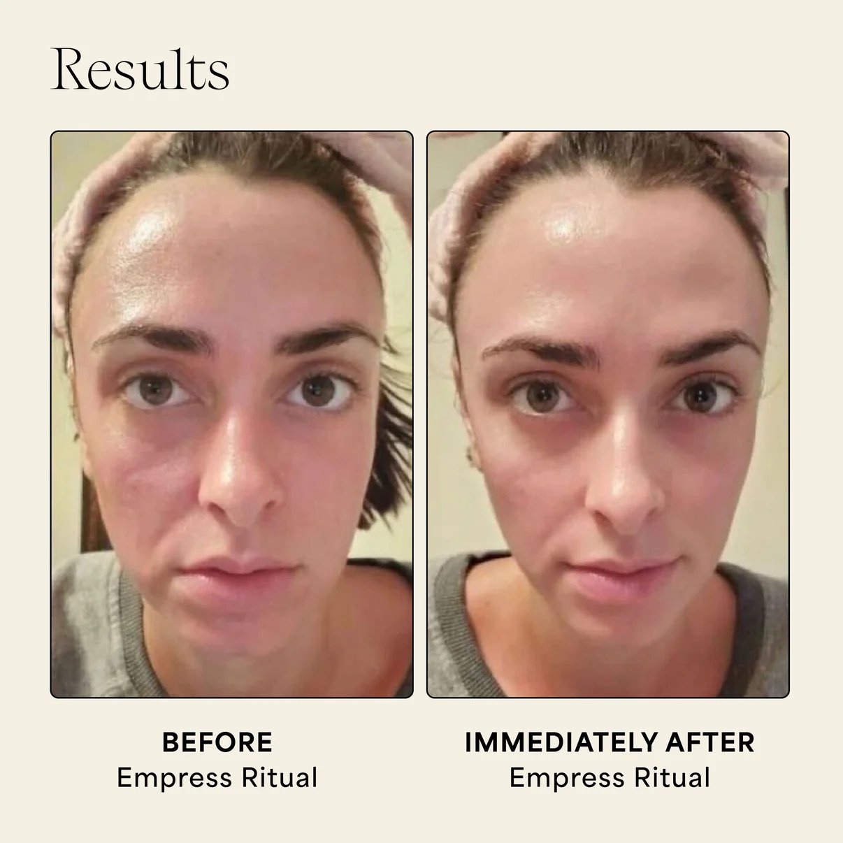 beforeandafter.jpg