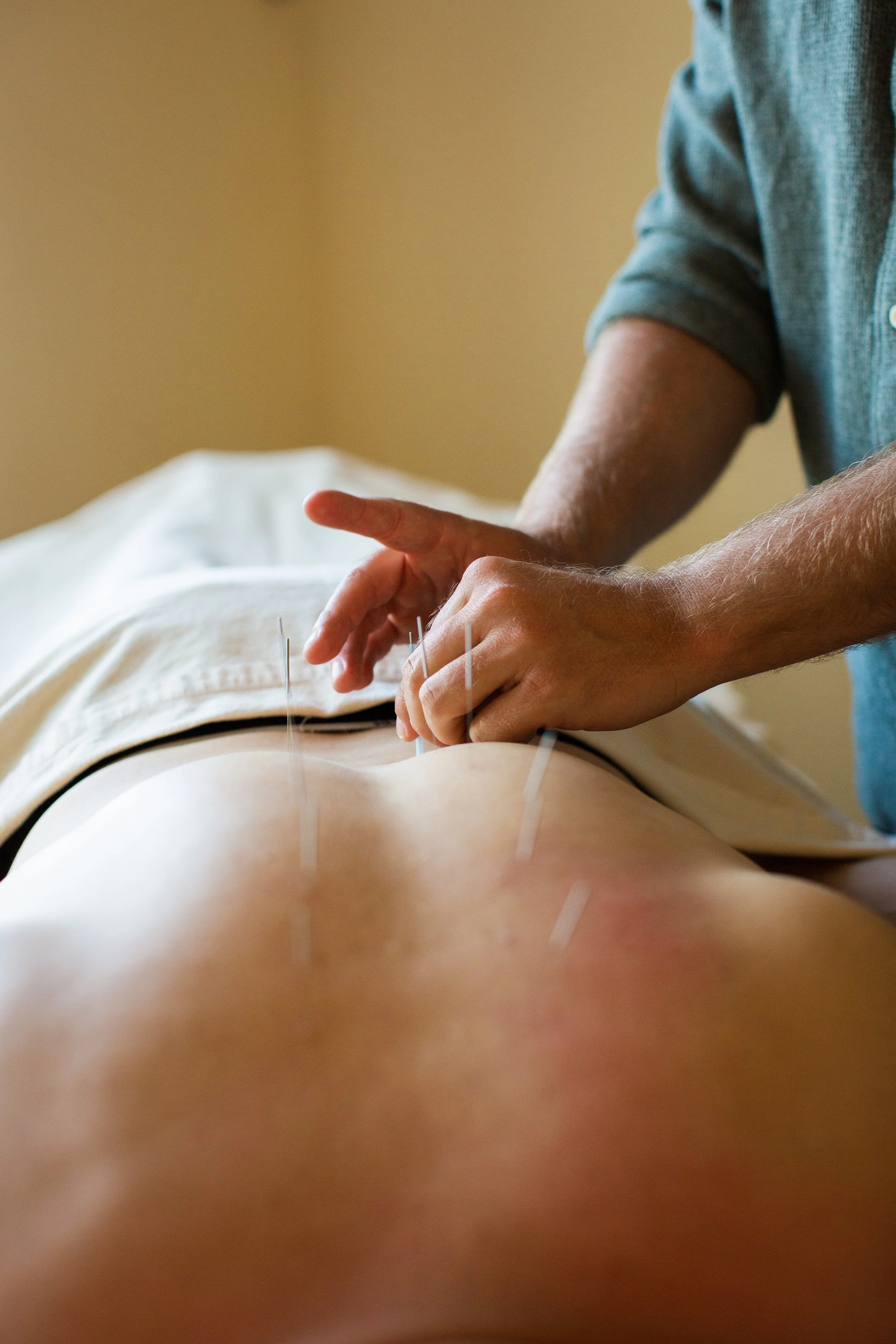Acupuncture & Bodywork
