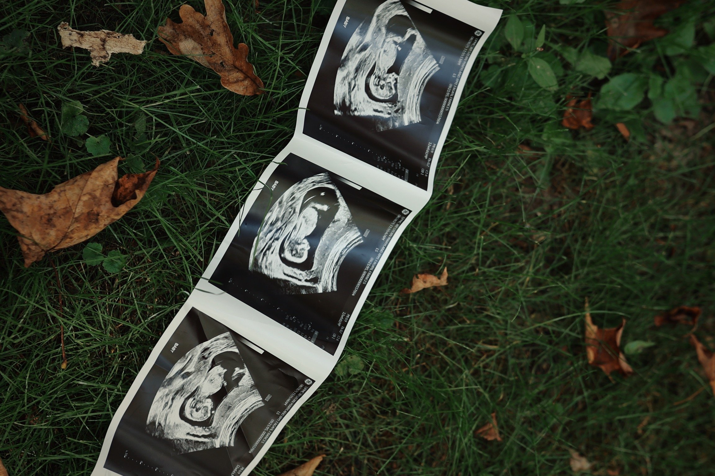 Ultrasound scan images of a fetus laid out on grass with fallen leaves surrounding them.