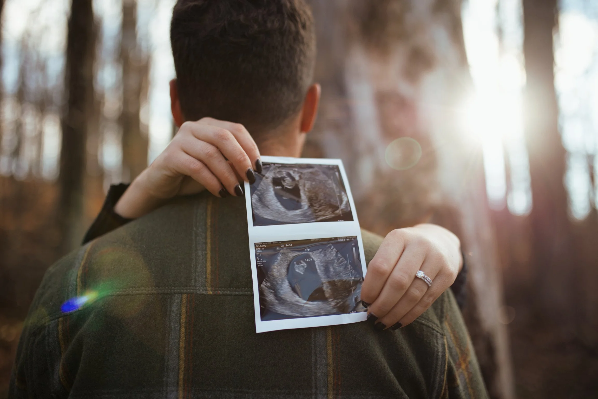 A woman holding two ultrasound pictures on a man's shoulder in a forest with sunlight filtering through the trees.