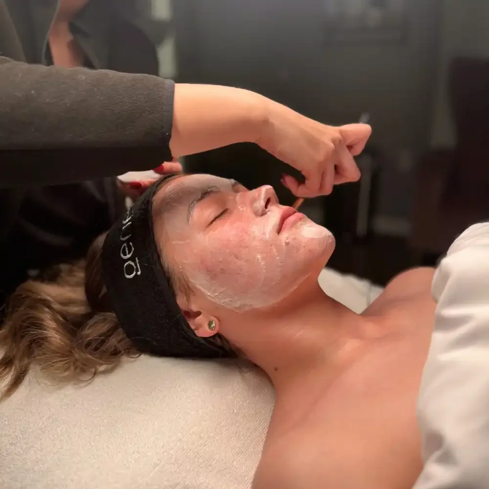 Chemical Peels