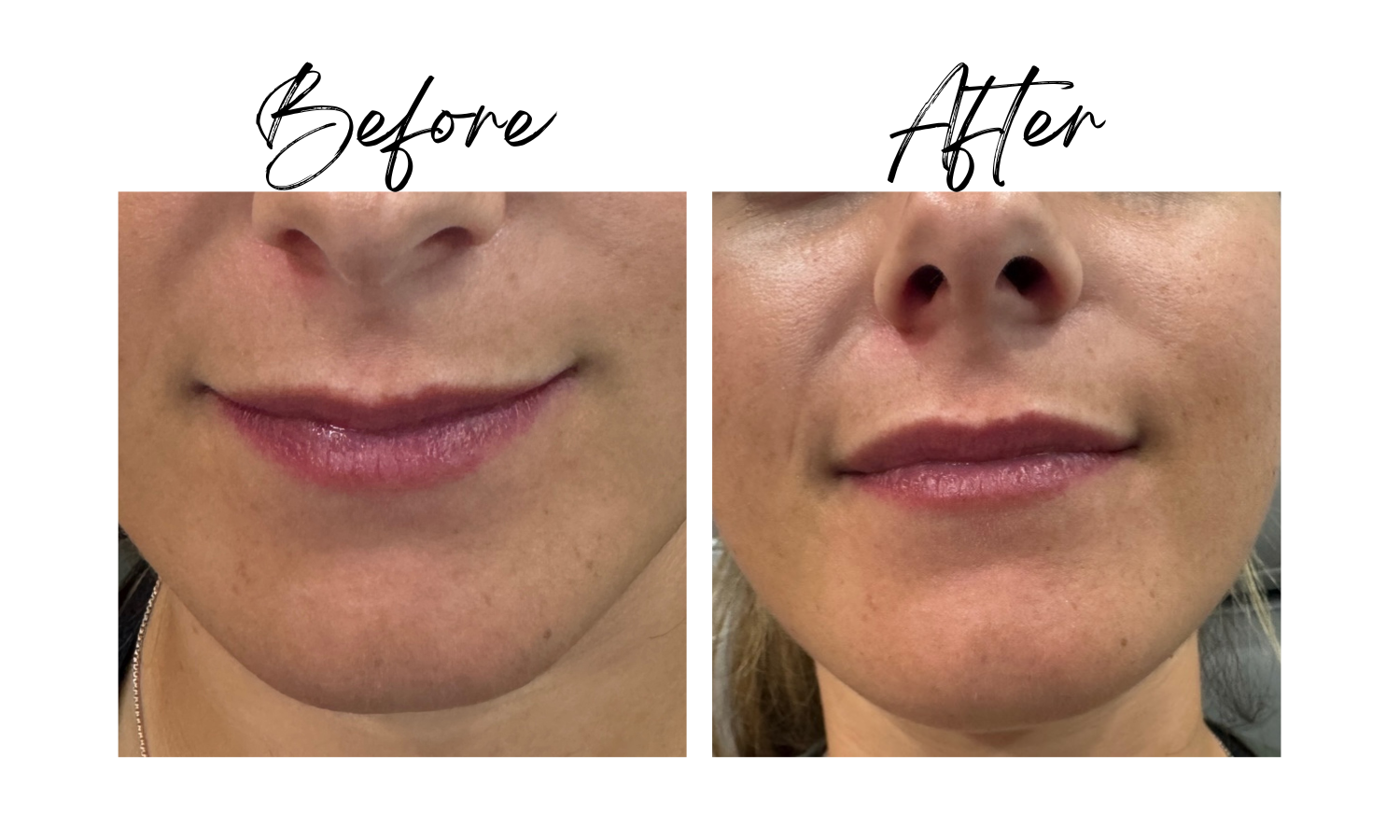 Before/After