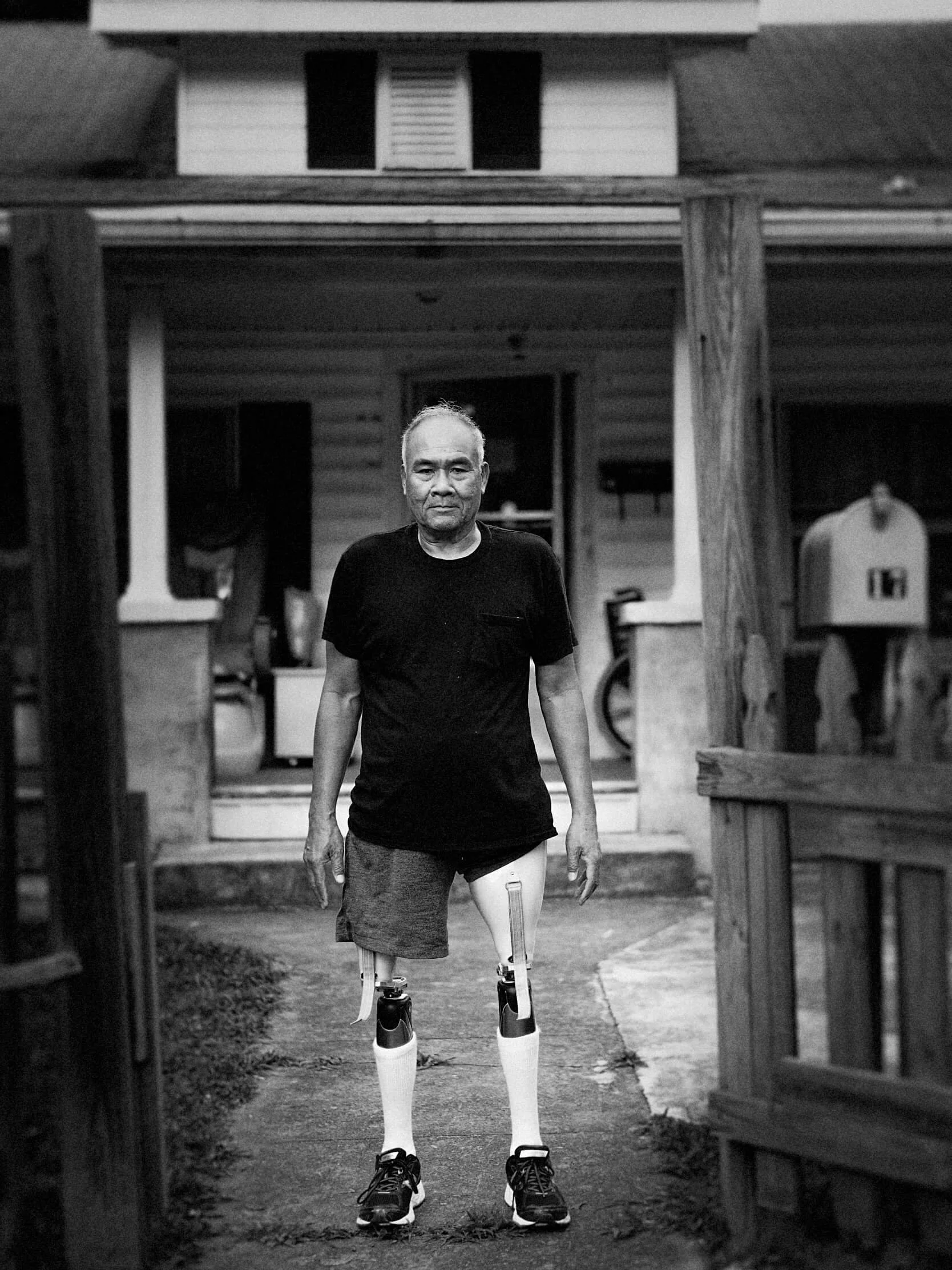 Parker J Pfister Fine Art Black and White Photography of a middle aged man standing in front of his house with two prosthetic legs.