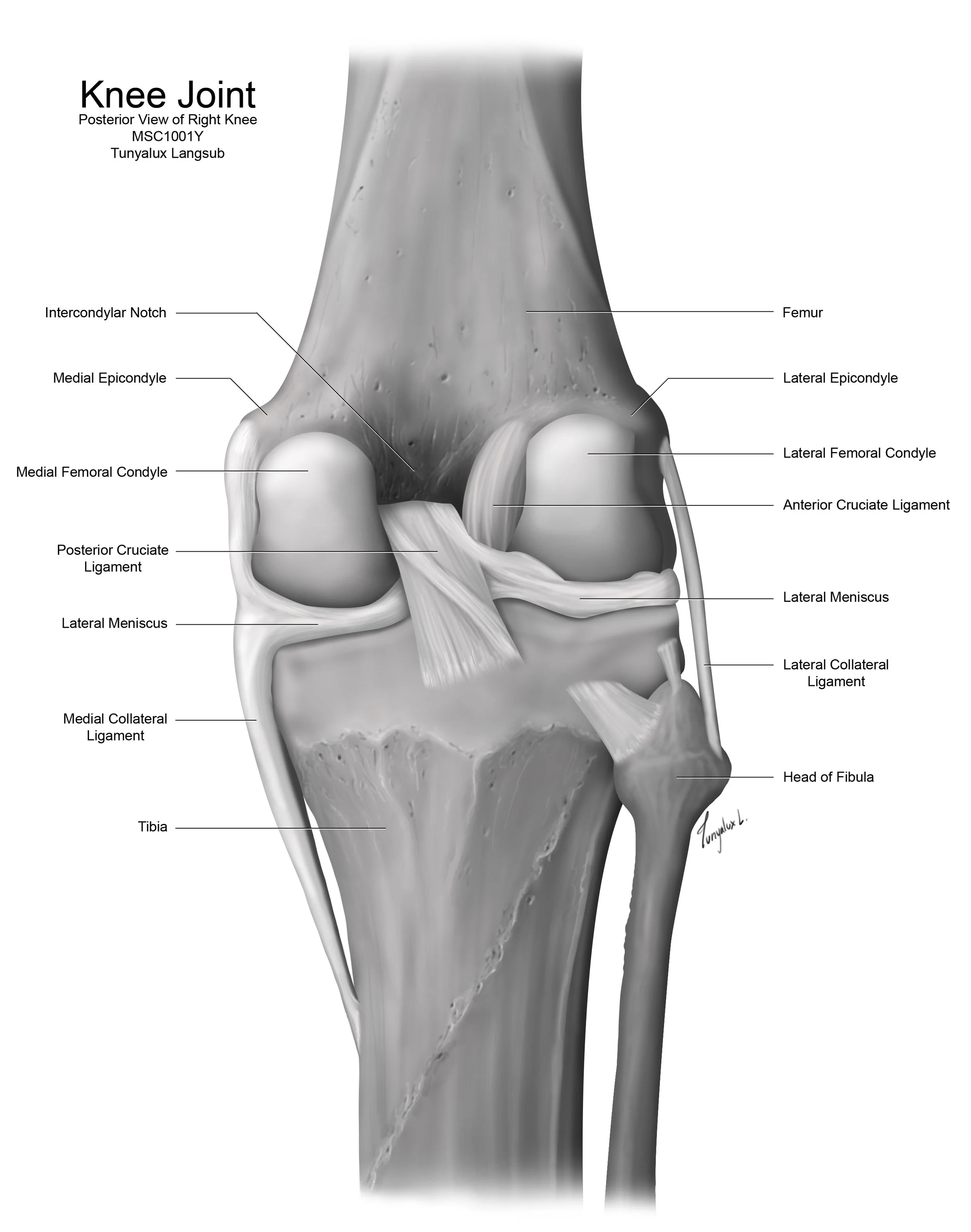 An anatomical illustration of the posterior view of the right knee joint, labeling bones, ligaments, menisci, and cartilage, including femur, tibia, fibula, menisci, collateral ligaments, cruciate ligaments, and other structures.