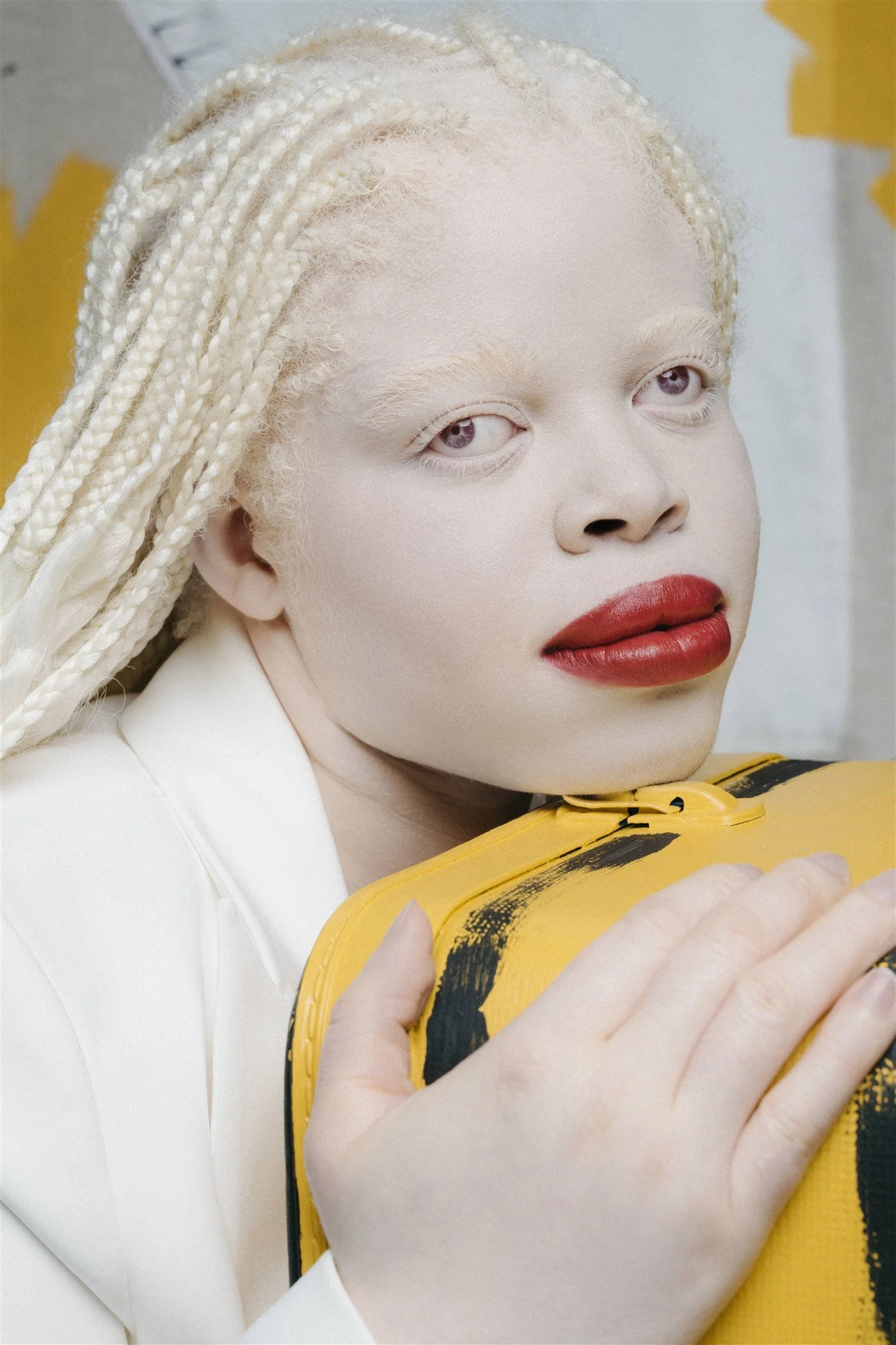 Personne albinos avec des tresses blondes et des lèvres rouges tenant un sac jaune.
