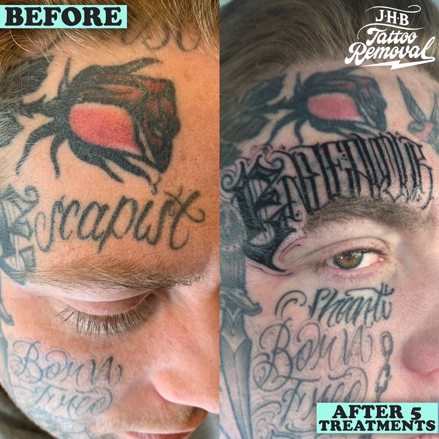 All covered and reworked for R! Thanks for choosing me again man! @pedro_tattoos did a great job aswell for the reworking of this! 

Nothing more nerve wracking than working on someone&rsquo;s face 😱 That skin has to be extra perfect at the end. We 