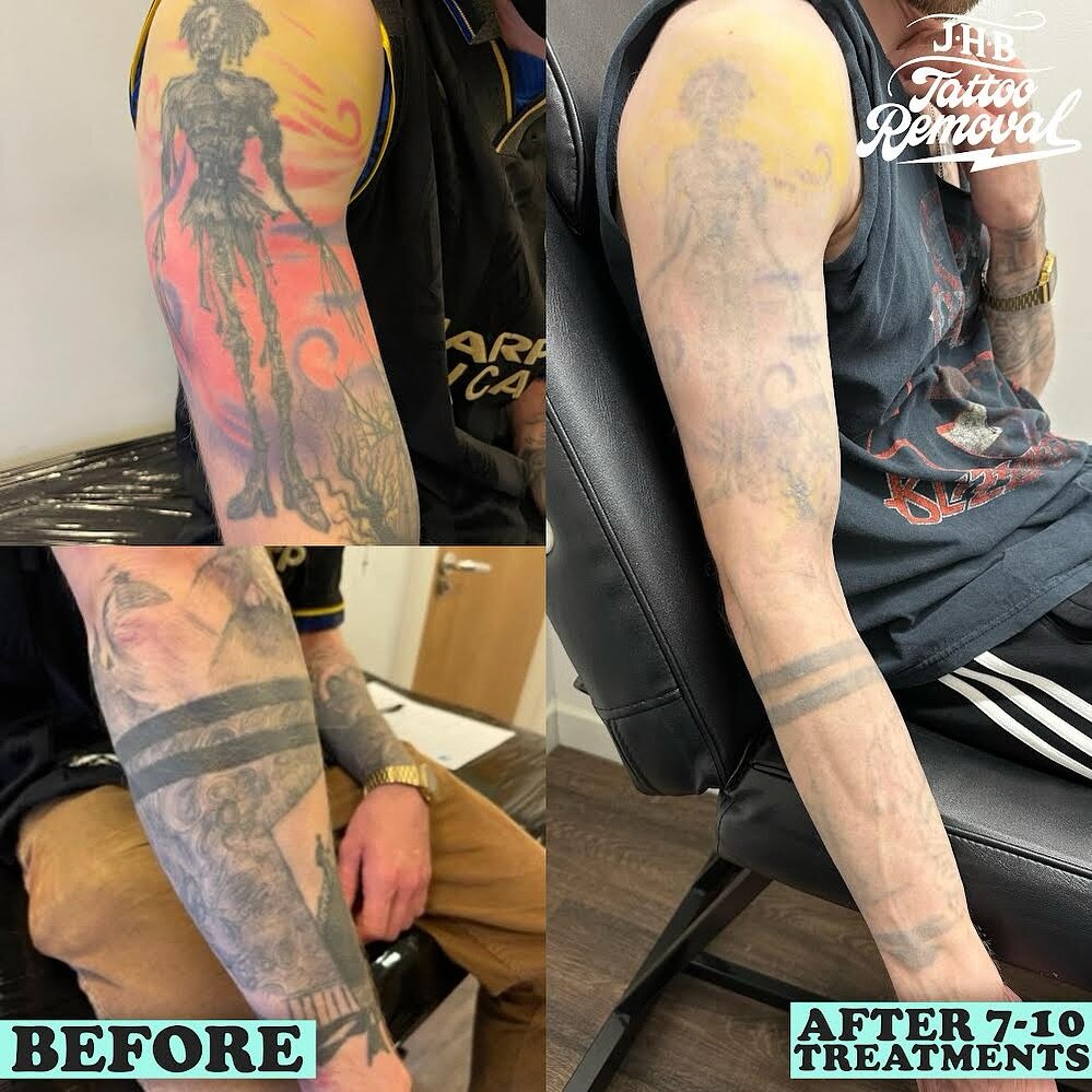 Here&rsquo;s a project I&rsquo;ve been working on, thanks for the commitment D! This guy is super-focused and now he&rsquo;s almost ready for his cover up. Some of the lighter grey areas have had less than the black and the colour has had a couple le