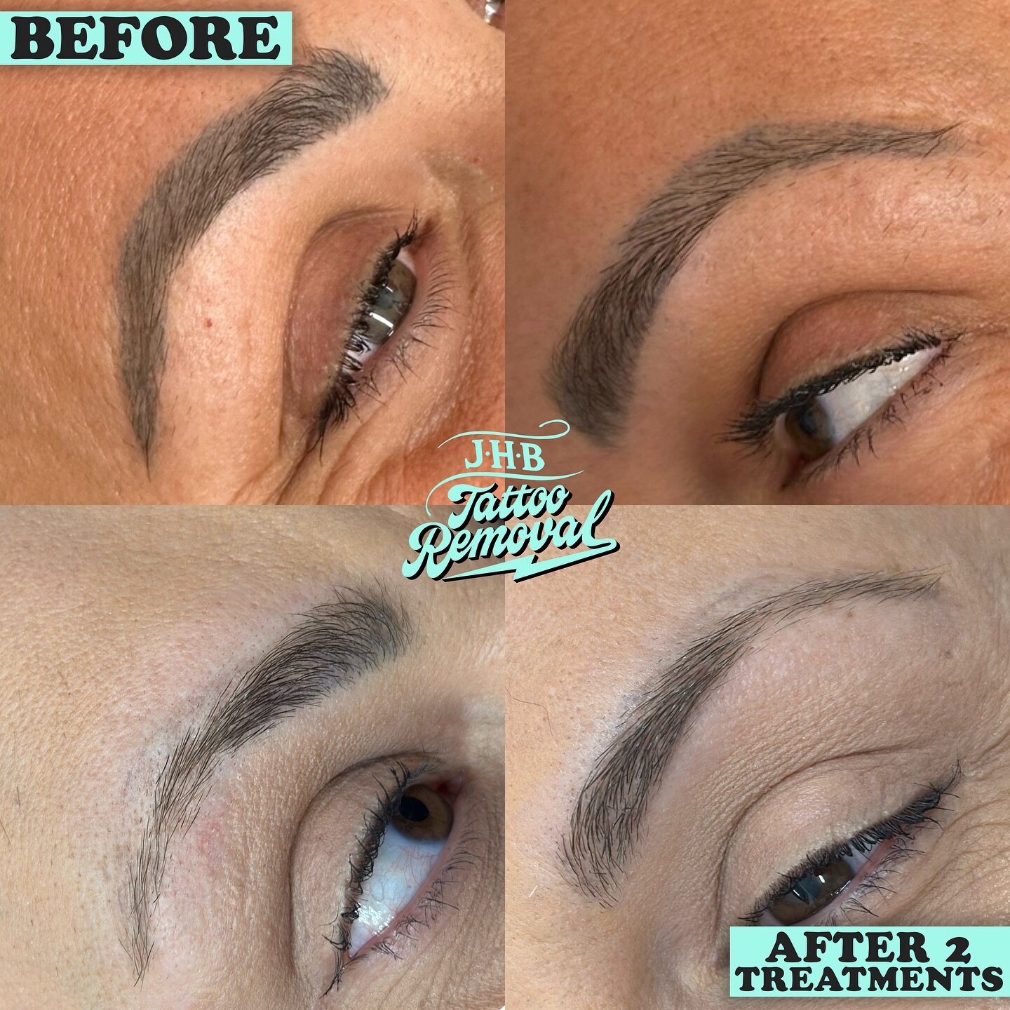 Thanks J for the trust! Nearly all done on this now after 2 passes! We did a 3rd to be safe but I&rsquo;m pretty sure that&rsquo;s the end now. Really happy with results on this. I&rsquo;m always happy to take more brows on so just reach out if you&r