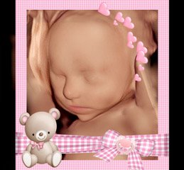 Custom Framed Ultrasound