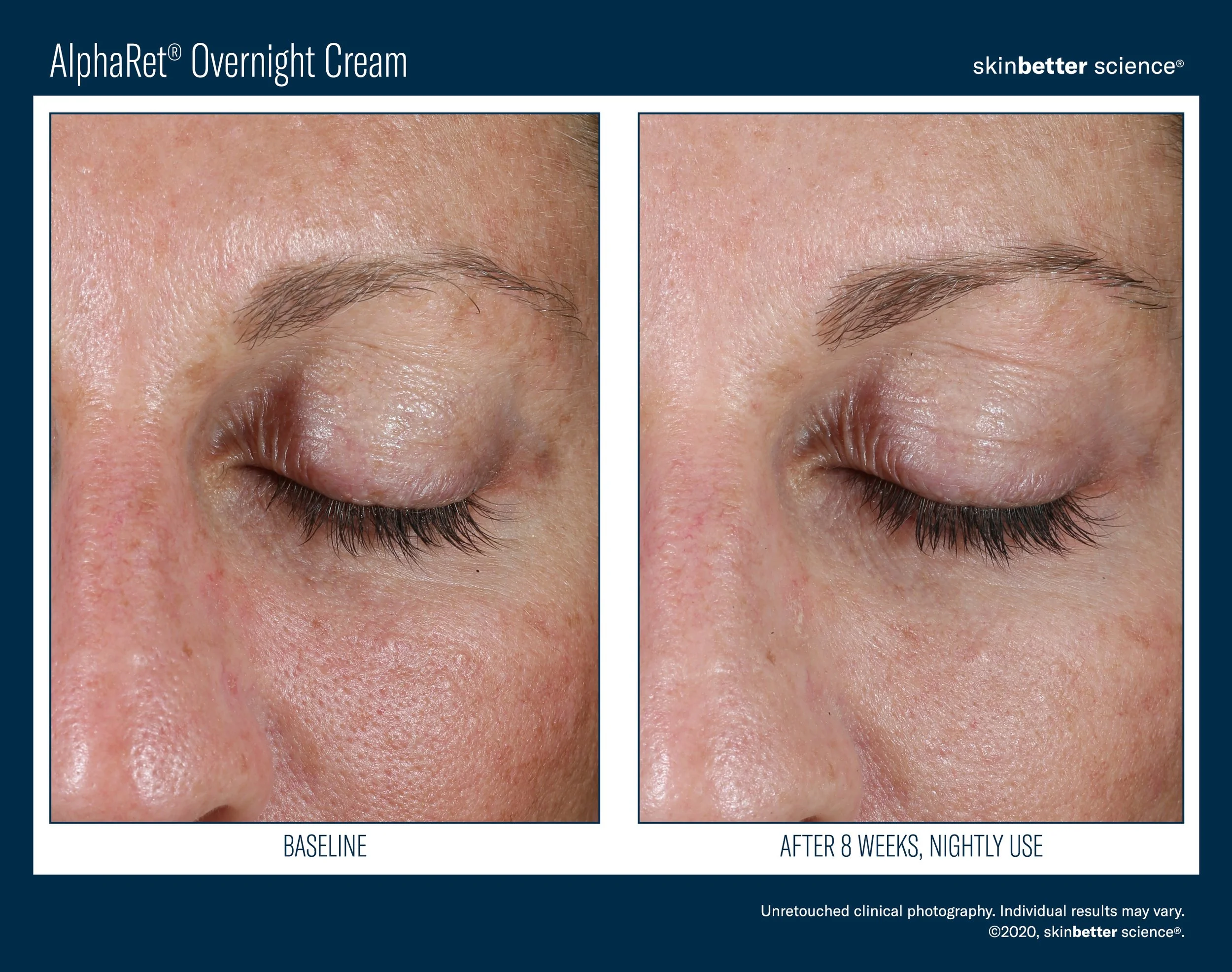 AlphaRet Before & After Template_2020(HQP)18.jpg