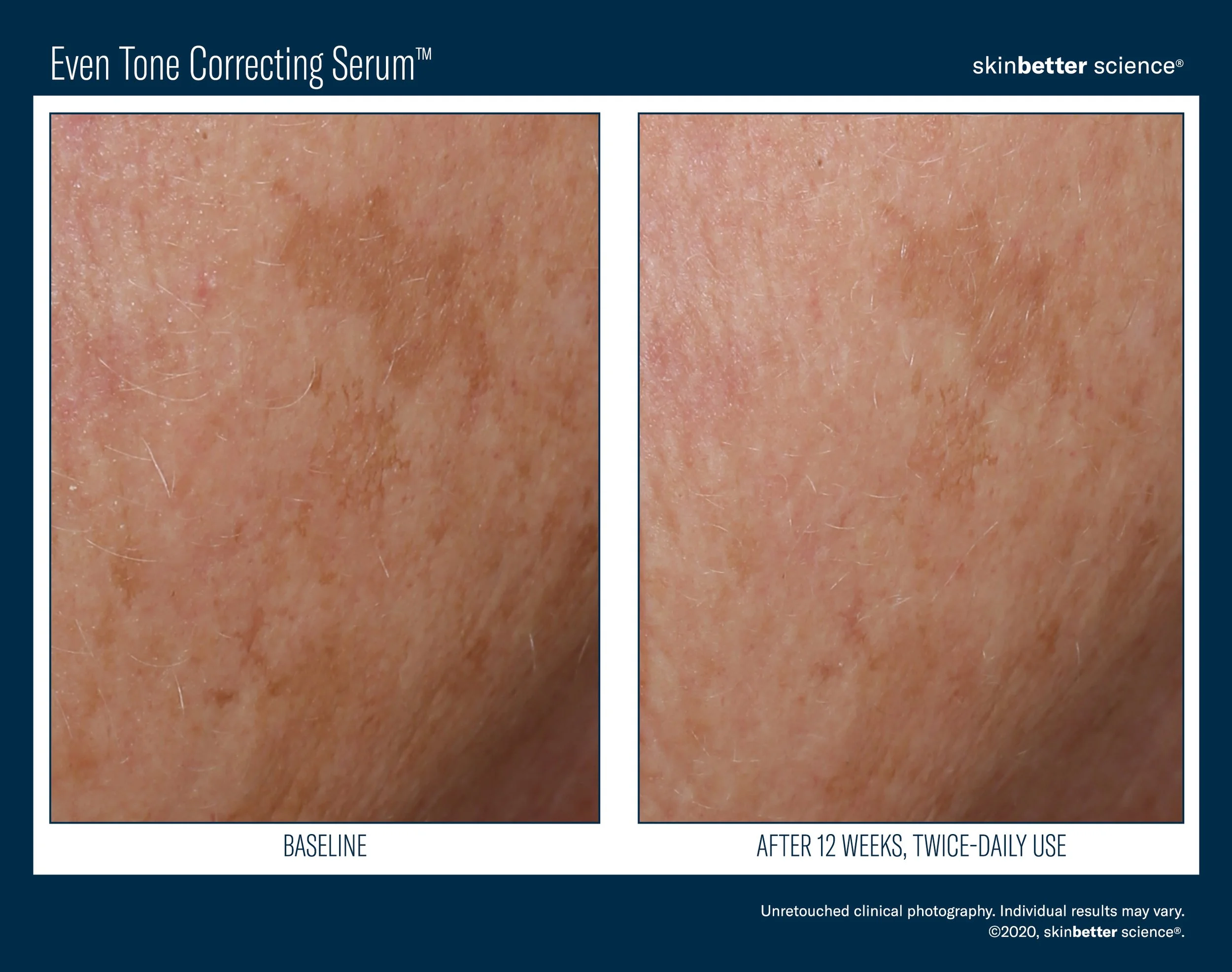 Even Before & After Template_2020(HQP)10.jpg