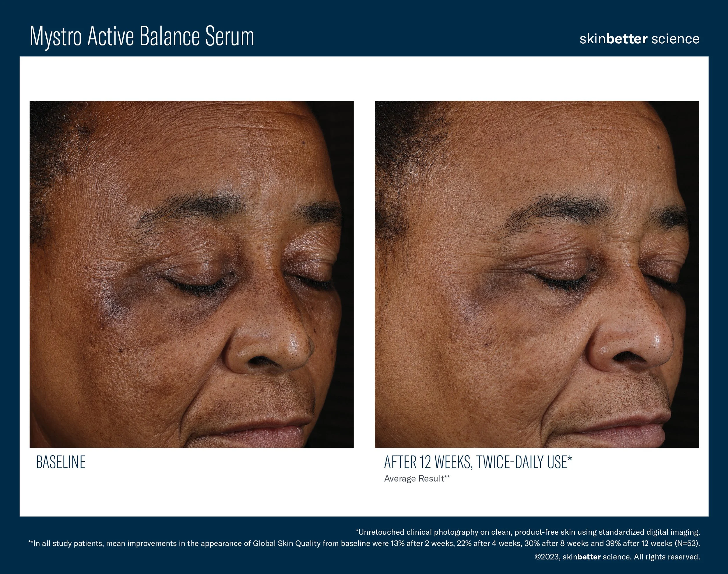 Mystro Active Balance Serum B&A Template10.jpg