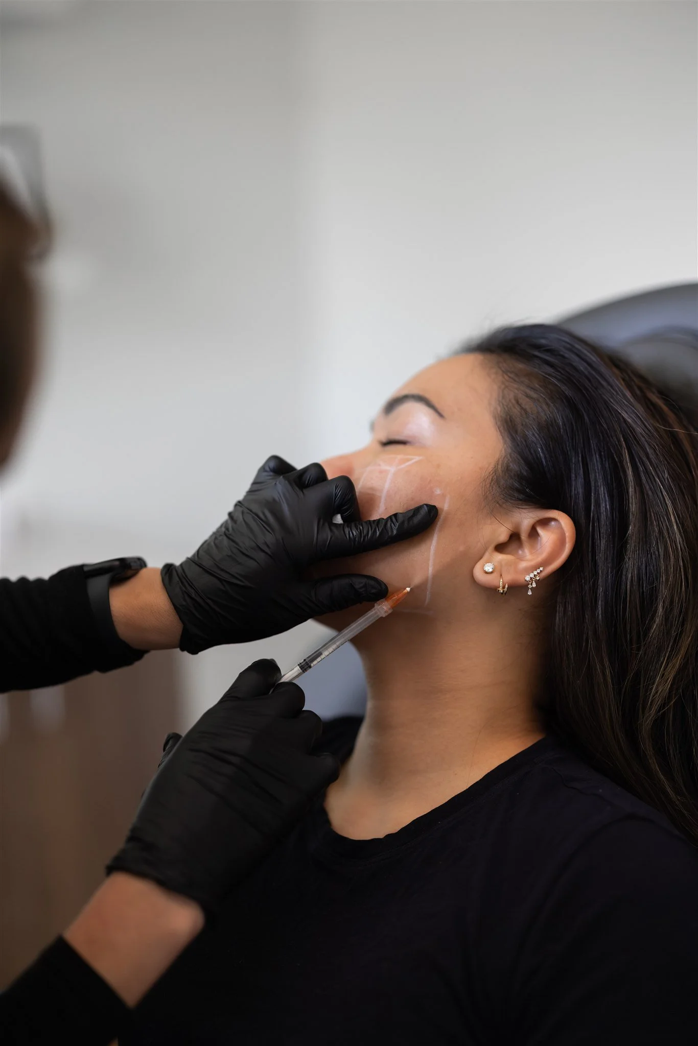 Aesthetic nurse practitioner performing a Sculptra treatment on patient at Trouvé Medspa in Northeast Ohio
