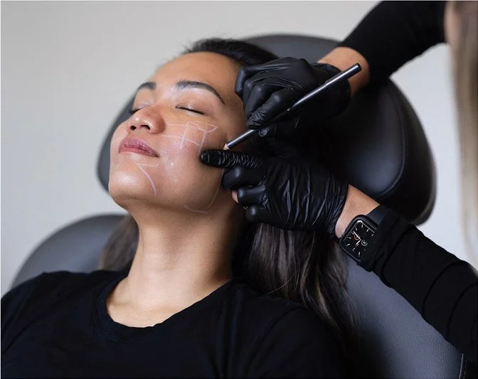 Sculptra at Trouve