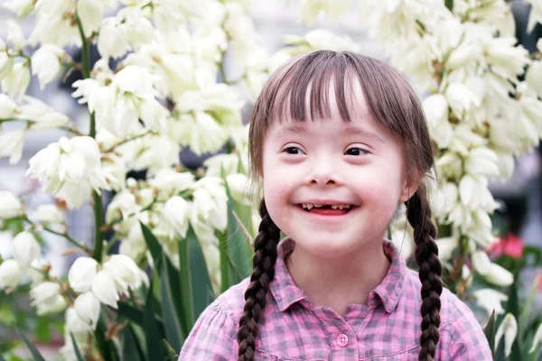 CU Uncovers a "Game-Changing Discovery" in Down Syndrome