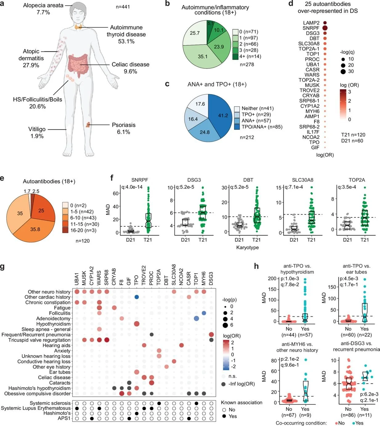 JAK inhibition decreases the autoimmune burden in Down syndrome