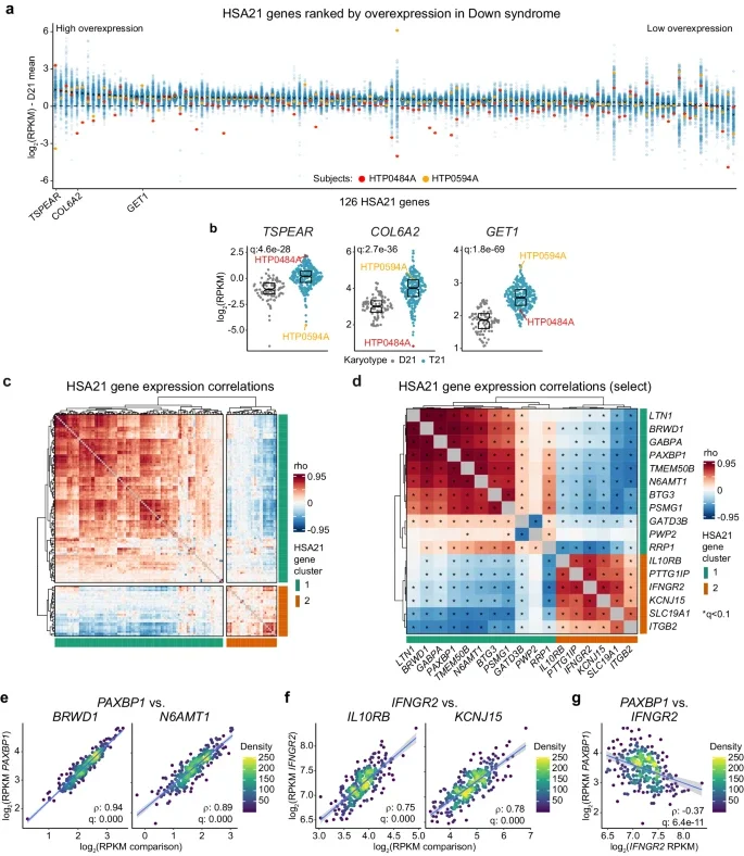 Variegated overexpression of chromosome 21 genes reveals molecular and immune subtypes of Down syndrome