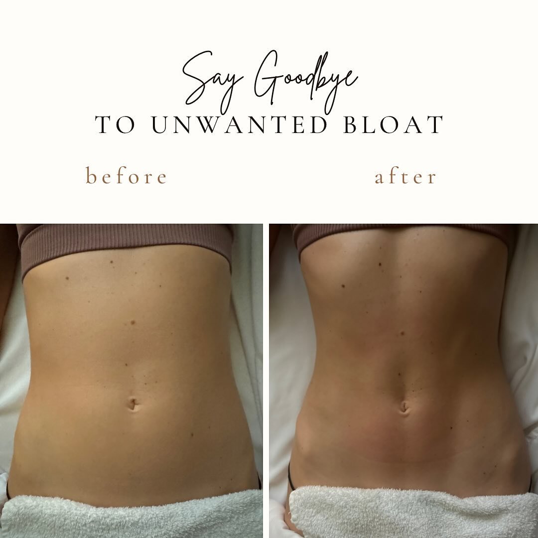 hello weekend! saying good bye to bloat, releasing toxins, and boosting the immune system ✨

dm us with any questions &amp; book at the link in bio 

#lymphaticmassages #lymphaticdrainage #woodtherapy #detox #bloat #woodtherapymassage
#massage #beaut