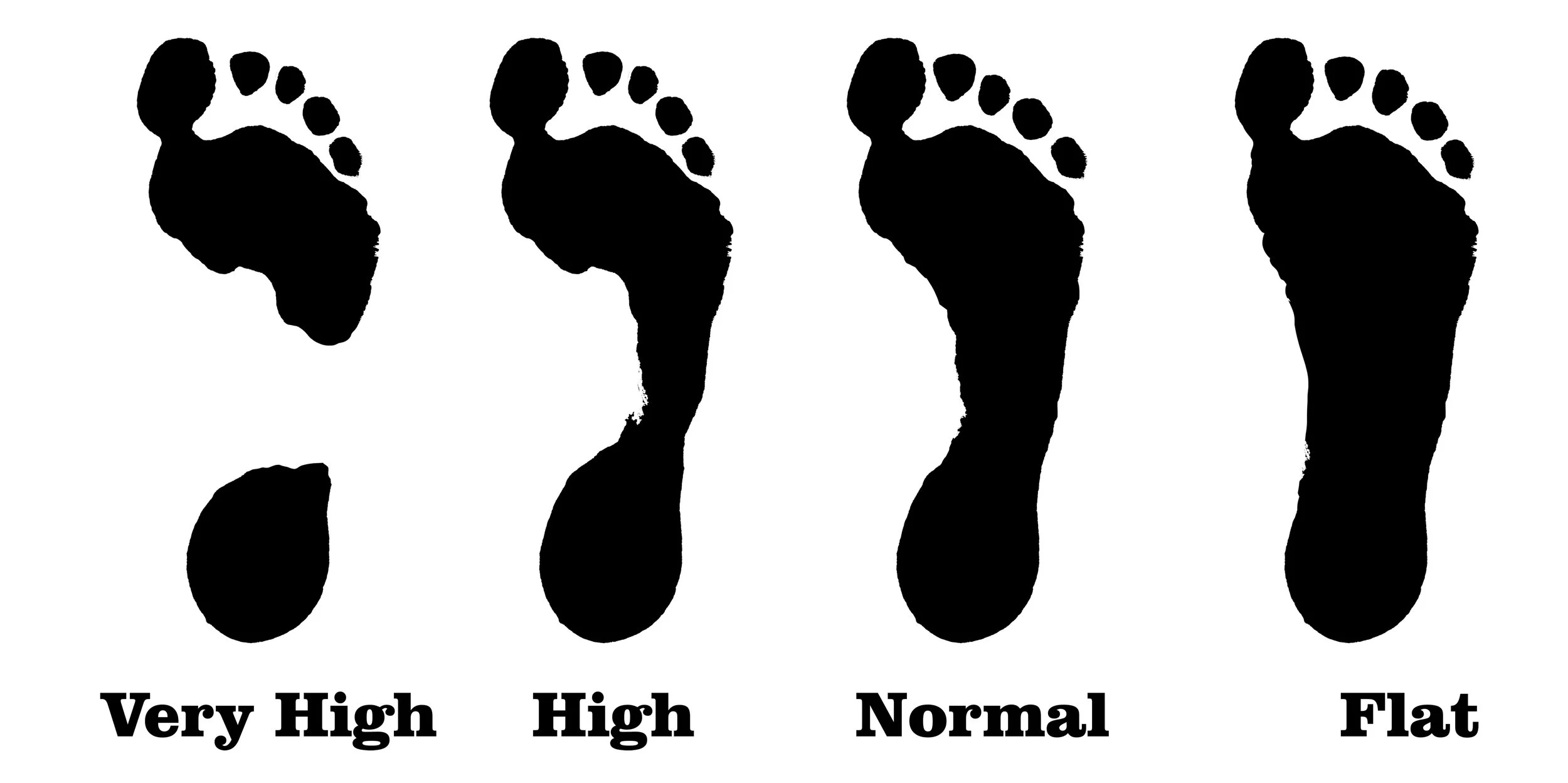 Understanding Foot Arch Types: Flat Feet, High Arches, and Everything In Between