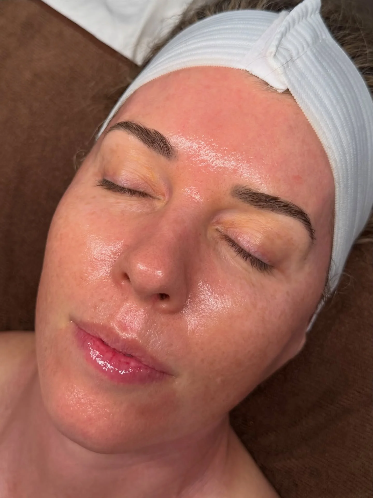 Our PDRN Nano-Infusion Facial speaks for itself 💧✨

This transformation is the result of two powerhouse treatments working together &mdash; Carboxy Oxygen Therapy + PDRN Nano-Infusion.

Carboxy therapy increases oxygen delivery to the skin, stimulat