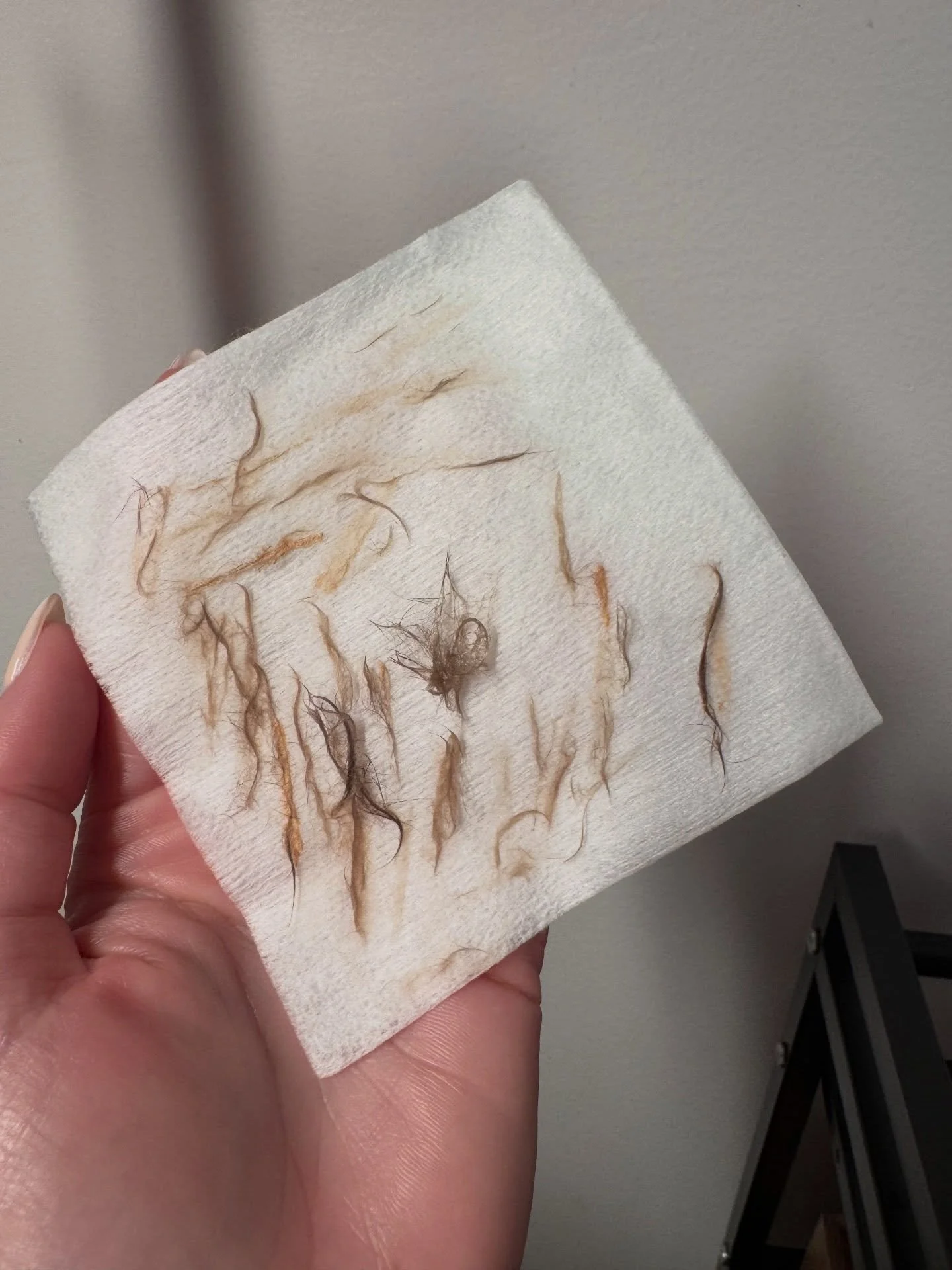 Dermaplaning isn&rsquo;t just about removing hair&mdash;
it&rsquo;s about clearing the buildup that blocks your skin from functioning at its best.

This is weeks of dead skin and vellus hair, gently removed to reveal a smoother, more radiant complexi