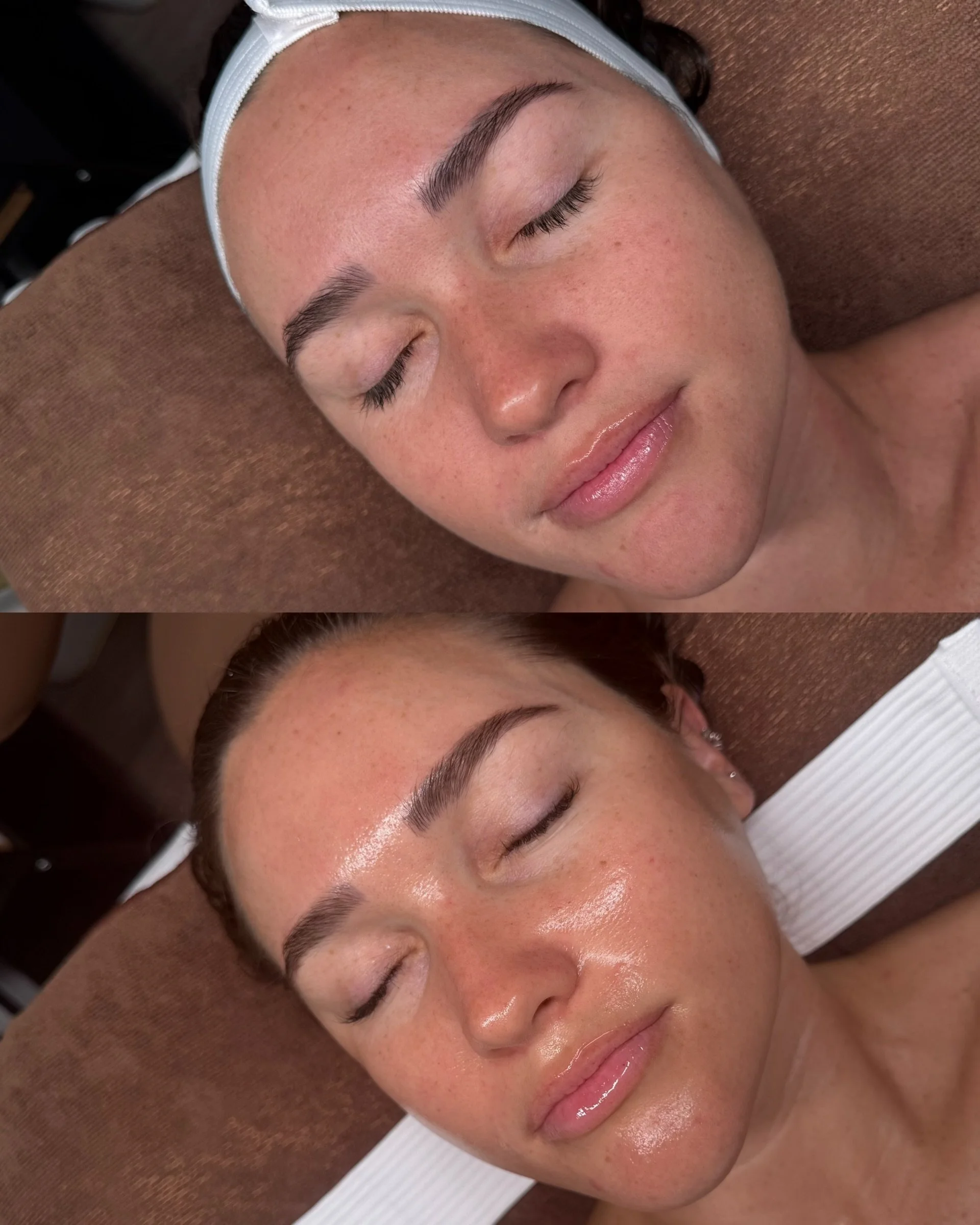 Healthy skin will always have a different kind of glow ✨

Hydrated, balanced, and intentionally treated for long-term skin wellness &mdash; not just a temporary fix🌿

This is the Botanica way✨

#skinhealth #skinwellness #hydrated #glowing #botanica