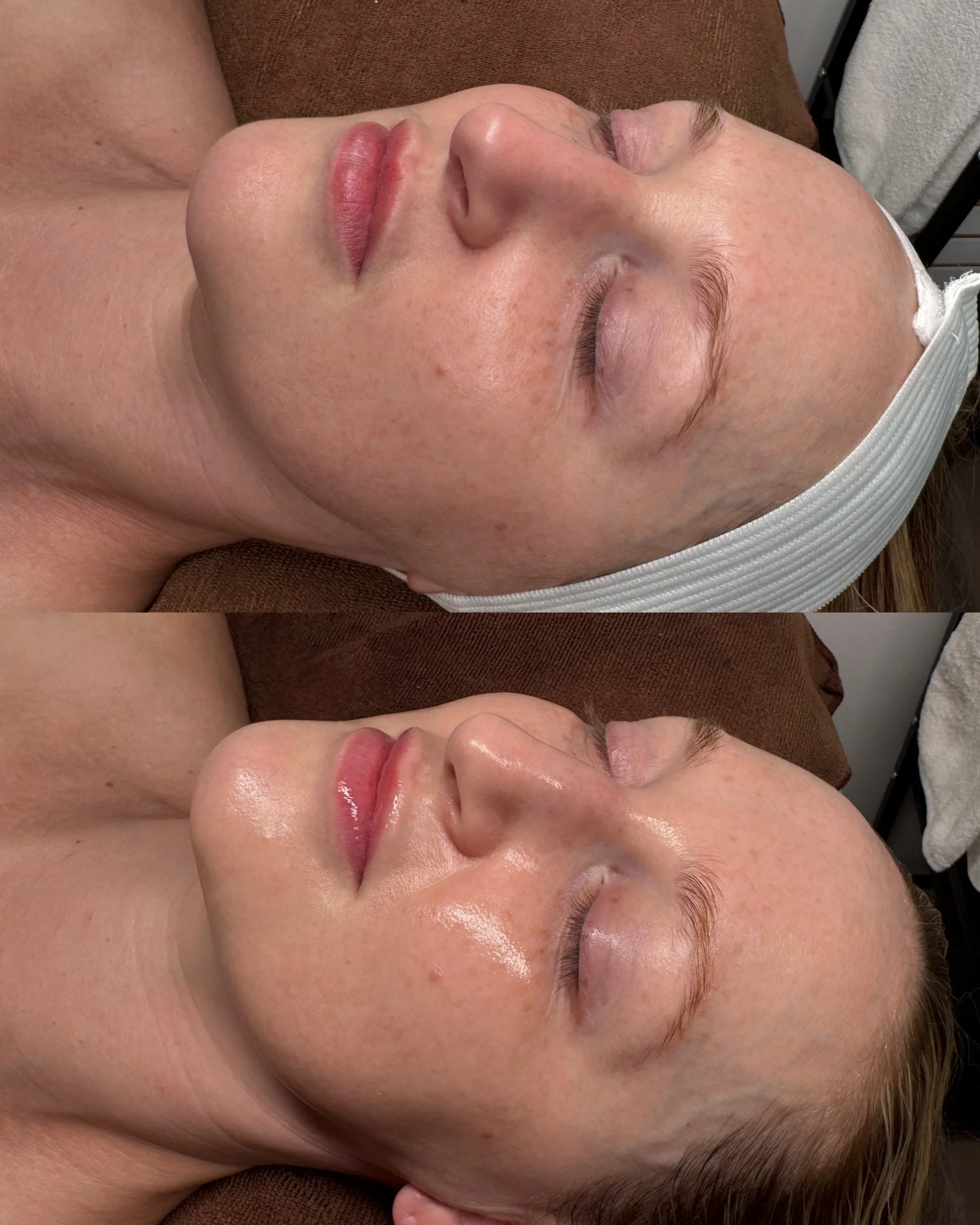 What a treat to have this gorgeous woman😍

Glass Skin Ritual SHOWING OUT✨✨✨

May I introduce @thepa_scarletthawkinschs the best Aesthetic Injector in the city! Kaitlyn Booth is the PA at Scarlett Hawkins Medspa located downtown. She has extensive ex