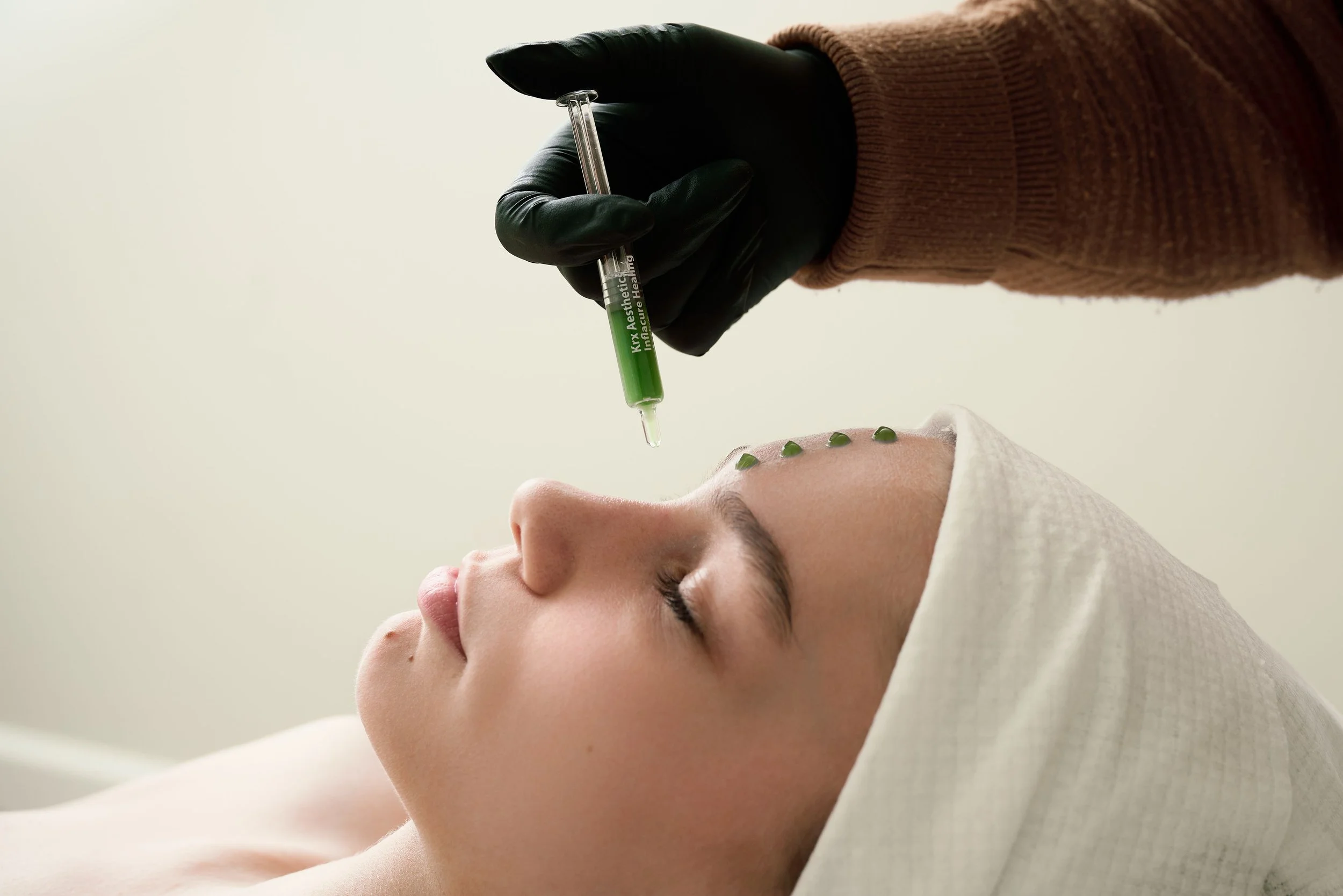 A woman lying down with a towel wrapped around her head, receiving an acupuncture treatment with several green needles on her forehead. A practitioner wearing black gloves and a brown sweater is holding a syringe with a green liquid.