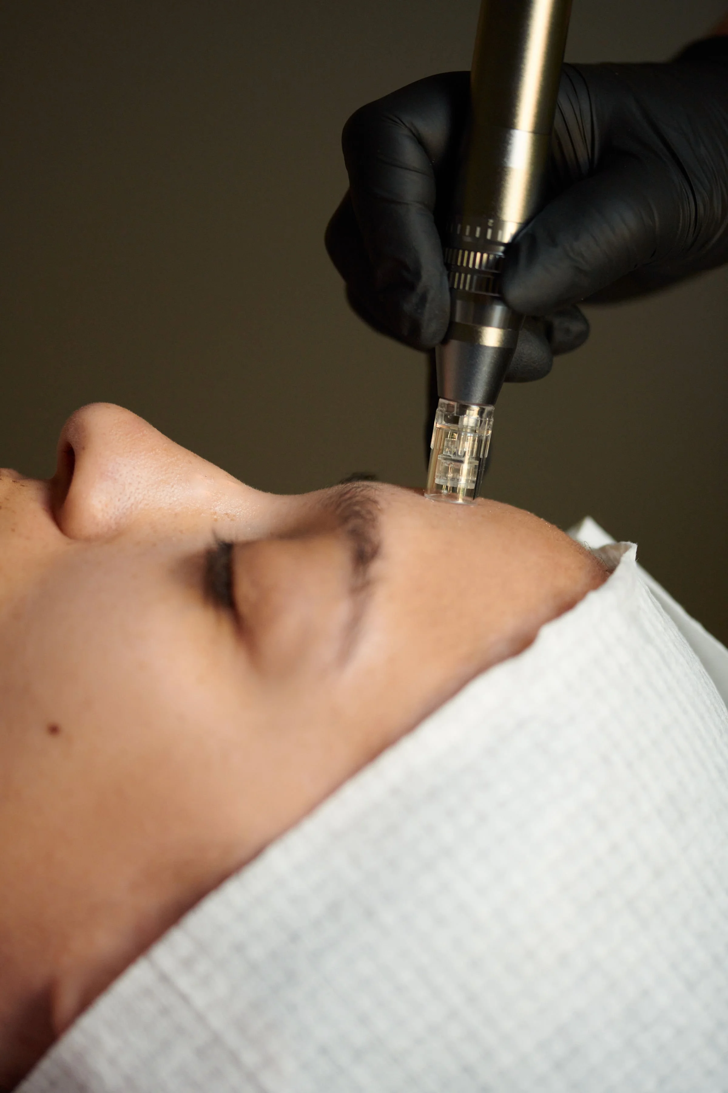 A person receiving a cosmetic or medical treatment on the forehead with a professional using a pen-like device while wearing black gloves.